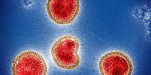 Infection with certain viruses like influenza, shown here, could raise the risk of neurodegenerative disease.