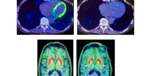 Heart and brain PET scans from a study participant