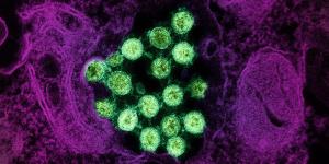 Transmission electron micrograph of SARS-CoV-2 virus particles (colorized green), isolated from a patient sample.