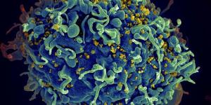 Human cell infected with HIV virus