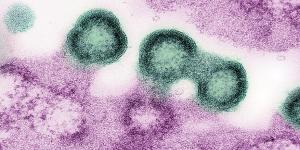 Transmission electron micrograph of HIV-1 virus particles (green) replicating from the plasma membrane of an H9 T cell (pink).