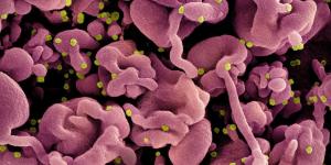 Colorized scanning electron micrograph of a cell (pink) infected with the Omicron strain of SARS-CoV-2 virus particles (yellow), isolated from a patient sample. Image captured at the NIAID Integrated Research Facility (IRF) in Fort Detrick, Maryland.