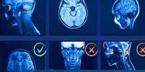 Image of six MRI scans with red Xs or green check marks and the question  - Which is the most likely diagnosis
